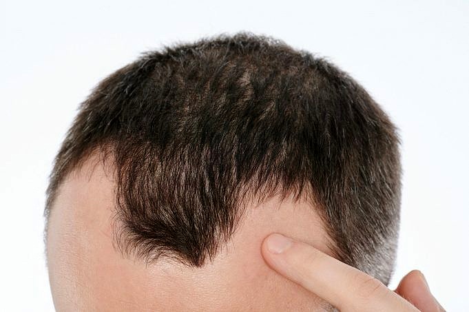 Die Starke Rolle Von Zink Beim Haarwachstum